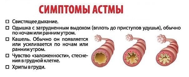 Симптомы бронхиальной астмы