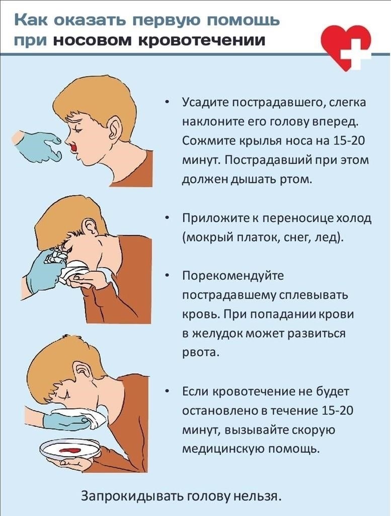 Почему у подростков часто идут носовые кровотечения?